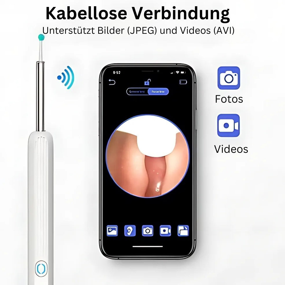 ClearView Pro | Visueller Ohrenreiniger mit HD-Kamera