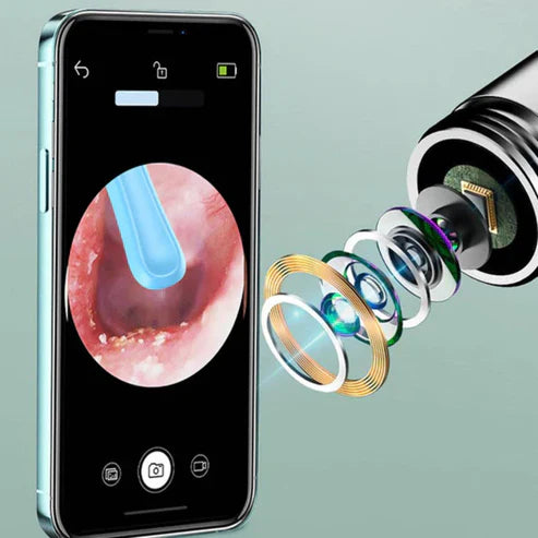 ClearView Pro | Visueller Ohrenreiniger mit HD-Kamera